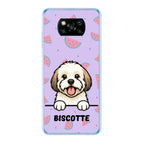 Meilleurs amis - Coque de téléphone personnalisée / Xiaomi / Poco X3 NFC / X3 Pro