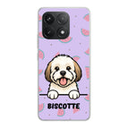 Meilleurs amis - Coque de téléphone personnalisée / Xiaomi / Poco F6 Pro / Redmi K70 / Redmi K70 Pro